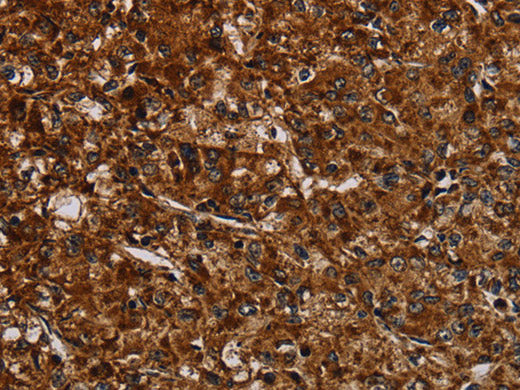 NDUFAB1 Polyclonal Antibody Store at -20°C