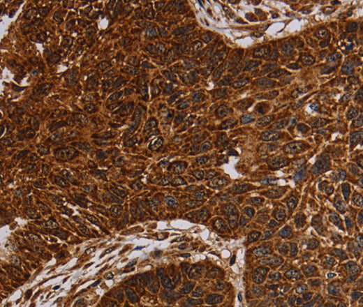 NDUFAB1 Polyclonal Antibody Store at -20°C