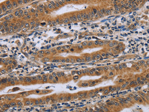 NDUFAF4 Polyclonal Antibody Store at -20°C