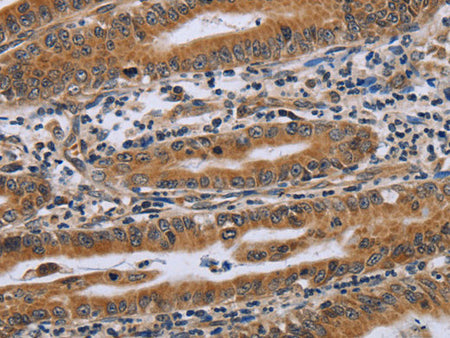 NDUFAF4 Polyclonal Antibody Store at -20°C
