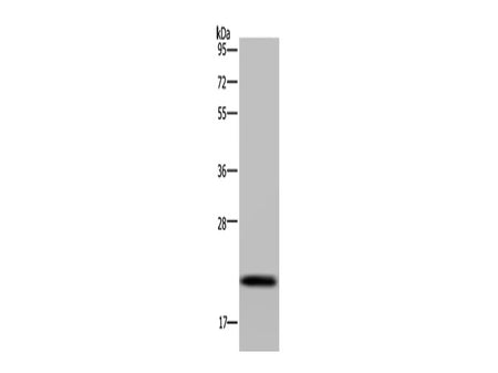 NDUFAF4 Polyclonal Antibody Store at -20°C