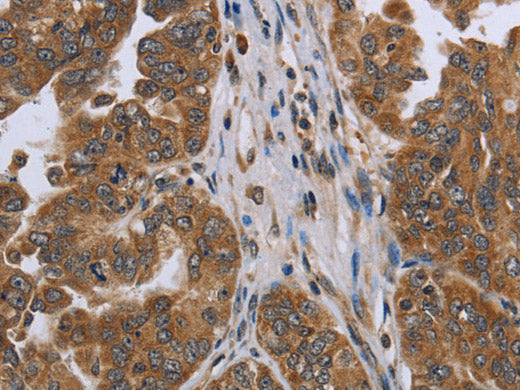 NDUFAF4 Polyclonal Antibody Store at -20°C