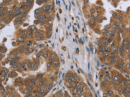 NDUFAF4 Polyclonal Antibody Store at -20°C