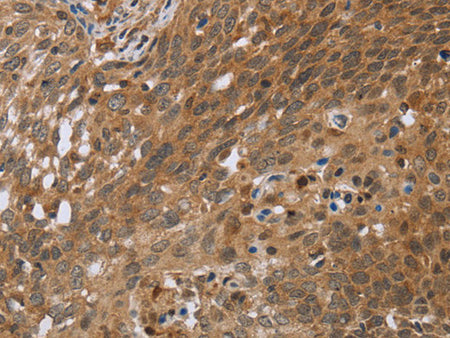 NDUFS2 Polyclonal Antibody Store at -20°C