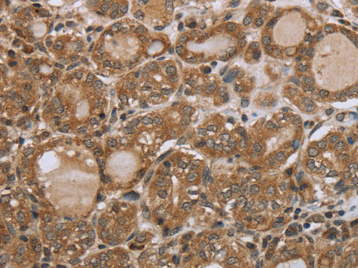 NDUFS2 Polyclonal Antibody Store at -20°C