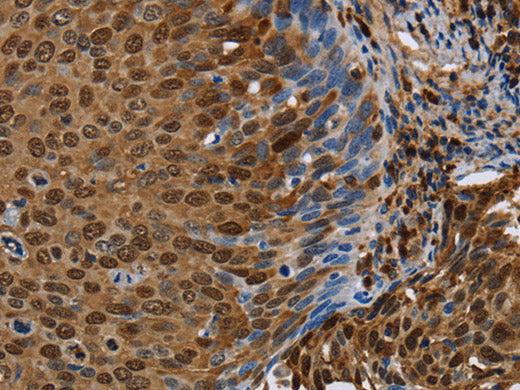 NRP2 Polyclonal Antibody Store at -20°C