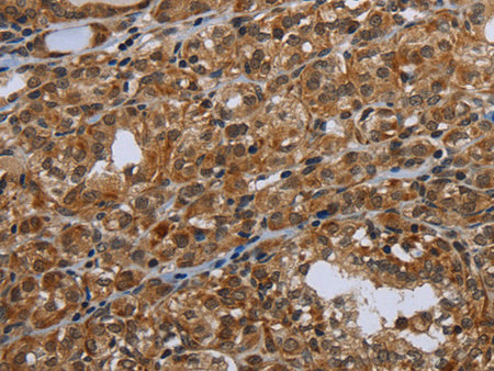 UHRF2 Polyclonal Antibody Store at -20°C