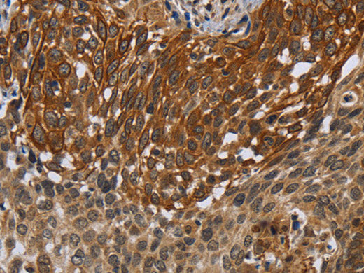 UHRF2 Polyclonal Antibody Store at -20°C
