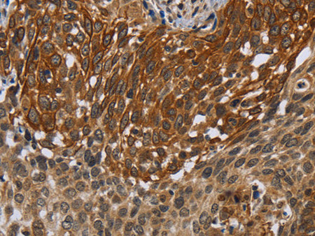 UHRF2 Polyclonal Antibody Store at -20°C