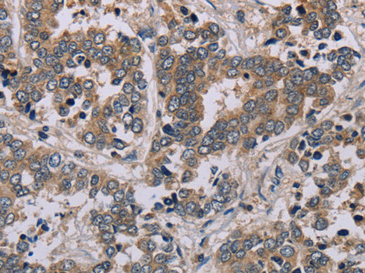 AATK Polyclonal Antibody Store at -20°C