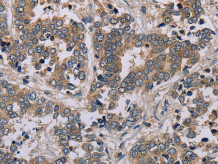 AATK Polyclonal Antibody Store at -20°C