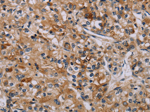 AATK Polyclonal Antibody Store at -20°C