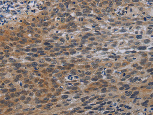 CCL1 Polyclonal Antibody Store at -20°C