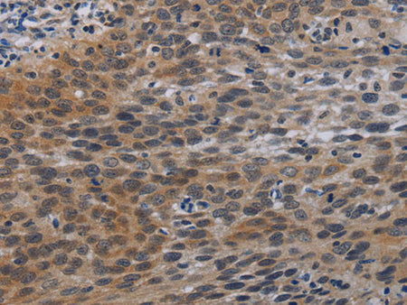 CCL1 Polyclonal Antibody Store at -20°C