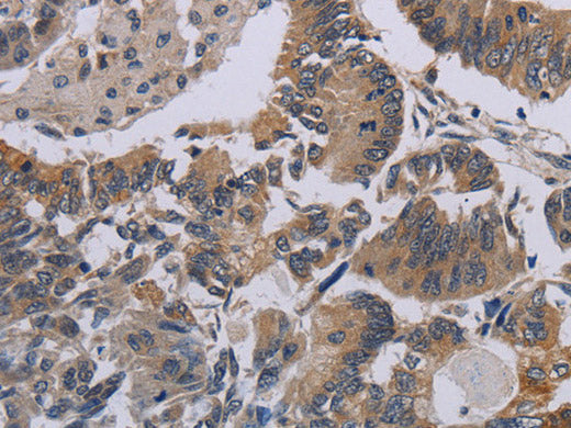 CCL1 Polyclonal Antibody Store at -20°C
