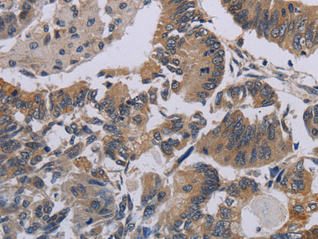 CCL1 Polyclonal Antibody Store at -20°C