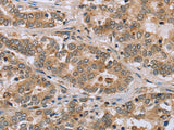 CLEC16A Polyclonal Antibody Store at -20°C