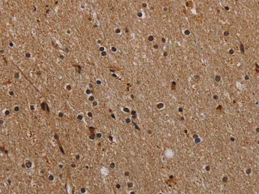 NLRP9 Polyclonal Antibody