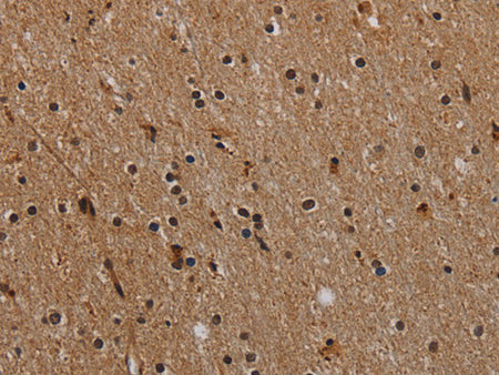 NLRP9 Polyclonal Antibody
