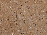 NLRP9 Polyclonal Antibody