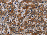 NLRP9 Polyclonal Antibody