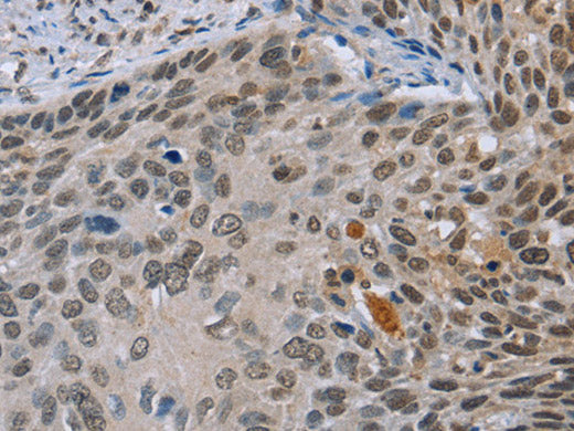 NMT1 Polyclonal Antibody Store at -20°C