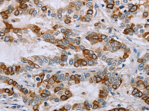 NMT1 Polyclonal Antibody Store at -20°C