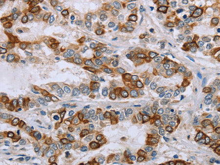 NMT1 Polyclonal Antibody Store at -20°C