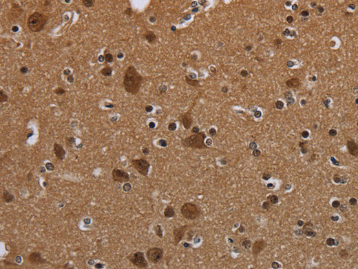 MYCN Polyclonal Antibody Store at -20°C