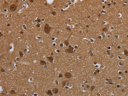 MYCN Polyclonal Antibody Store at -20°C