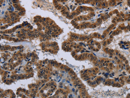 MYCN Polyclonal Antibody Store at -20°C