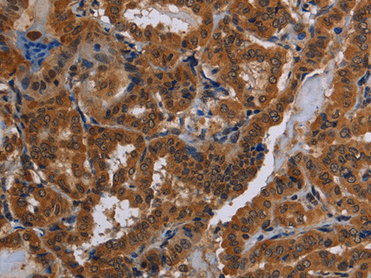 CYBB Polyclonal Antibody Store at -20°C