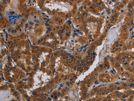 CYBB Polyclonal Antibody Store at -20°C