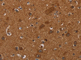 CYBB Polyclonal Antibody Store at -20°C