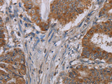 NOX3 Polyclonal Antibody Store at -20°C