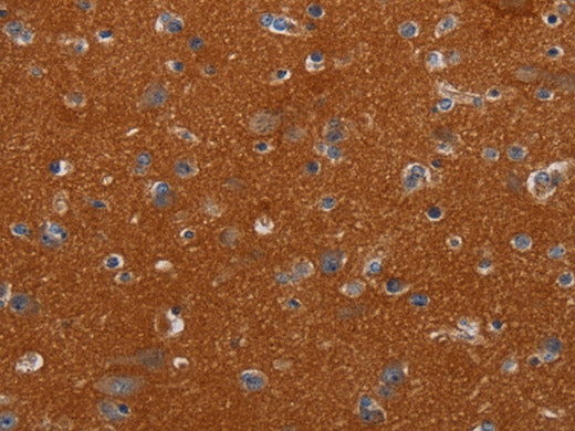NOX3 Polyclonal Antibody Store at -20°C