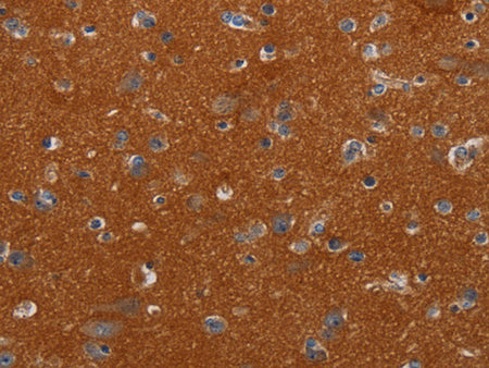 NOX3 Polyclonal Antibody Store at -20°C