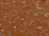NOX3 Polyclonal Antibody Store at -20°C