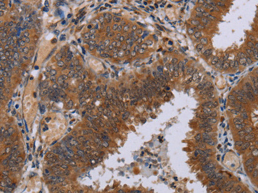 NPTX1 Polyclonal Antibody Store at -20°C