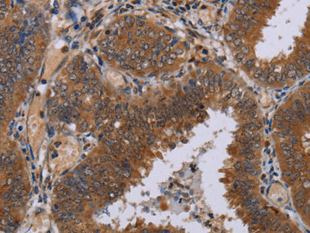 NPTX1 Polyclonal Antibody Store at -20°C