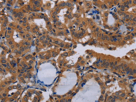 DCAF6 Polyclonal Antibody Store at -20°C