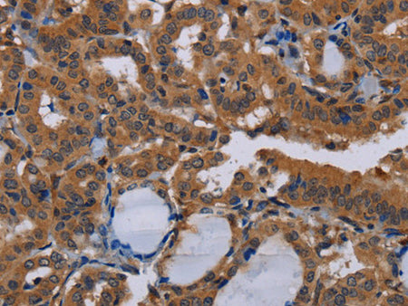 DCAF6 Polyclonal Antibody Store at -20°C