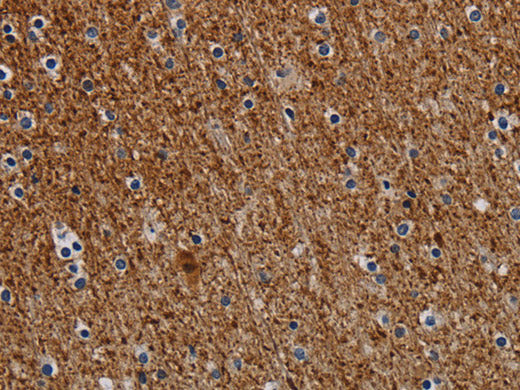 DCAF6 Polyclonal Antibody Store at -20°C