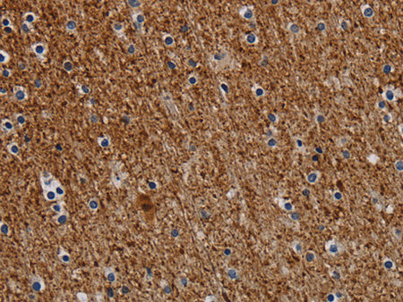 DCAF6 Polyclonal Antibody Store at -20°C