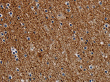 DCAF6 Polyclonal Antibody Store at -20°C