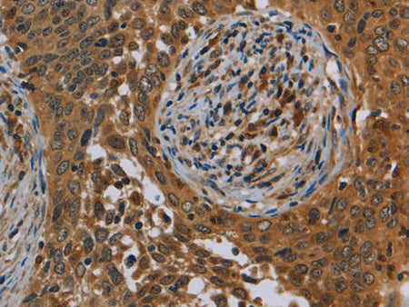 OSM Polyclonal Antibody Store at -20°C