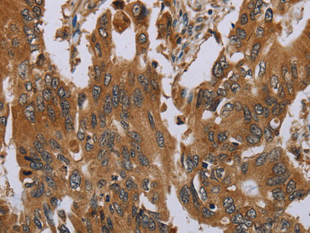 OSM Polyclonal Antibody Store at -20°C