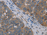 OTOR Polyclonal Antibody
