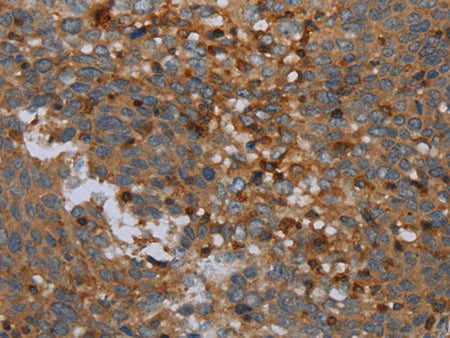 OTOR Polyclonal Antibody
