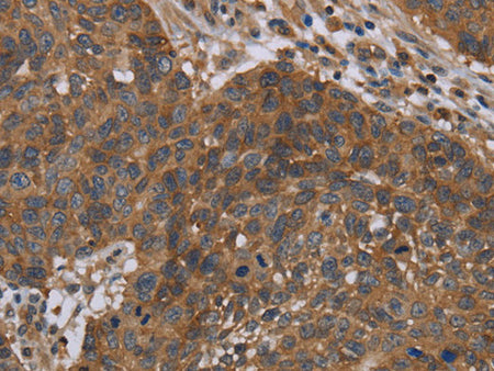 OXTR Polyclonal Antibody Store at -20°C